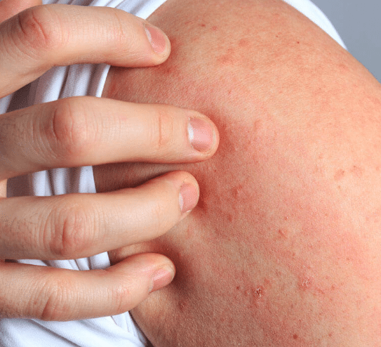 Sintomas Físicos da Ansiedade